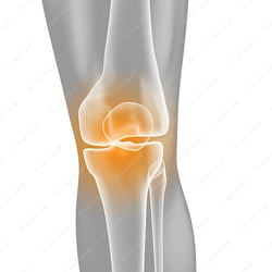 Medizinische 3D Grafik – Knieschmerzen Anatomie
