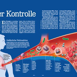 Sepsis, wie gefährlich ist die Blutvergiftung