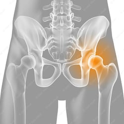 Anatomische 3D-Illustration – Gelenkschmerzen