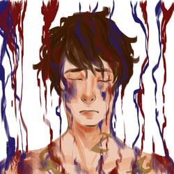 Colorful bruises