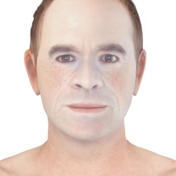 PFV Antlitzdiagnostik Male No4