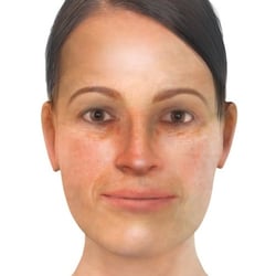 PFV Antlitzdiagnostik FeMale No1