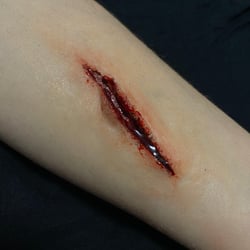 Wachswunde