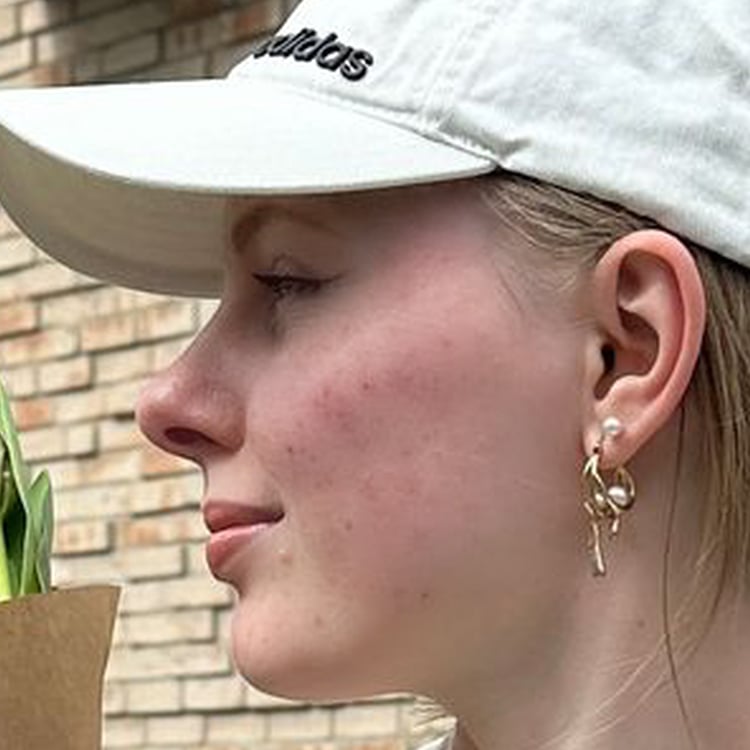 Annika Diederichs