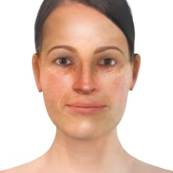 PFV Antlitzdiagnostik FeMale No1