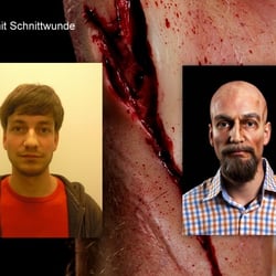 Alter Mann mit Schnittwunde