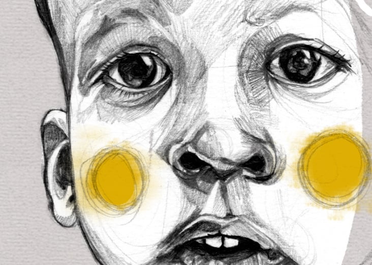 Detail 1