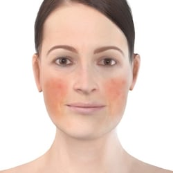 PFV Antlitzdiagnostik FeMale No7