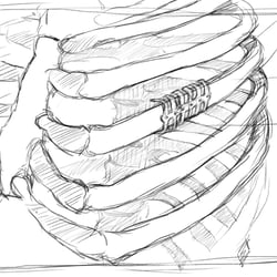 MedXpert STRACOS 3D‑Rippenklammer 3D-Animation Storyboard