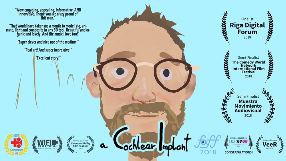 A CI