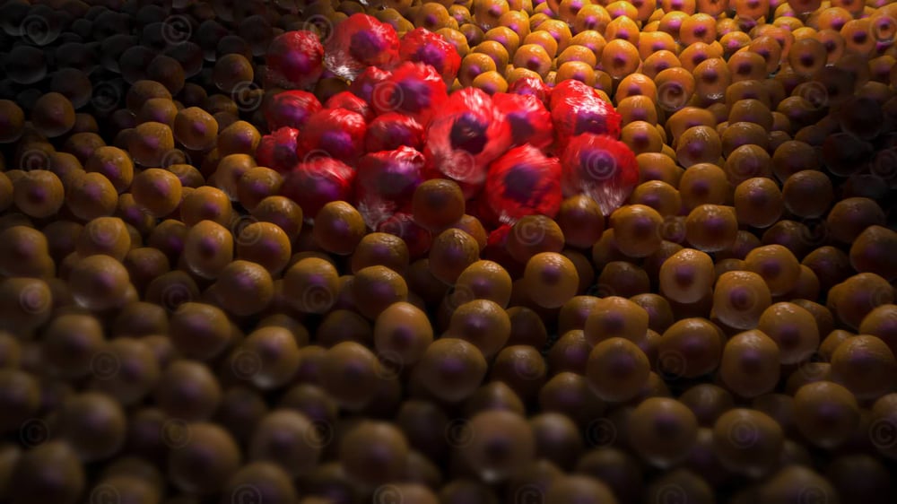 3D Animation zum Wachstum von Krebszellen