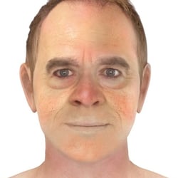 PFV Antlitzdiagnostik Male No10