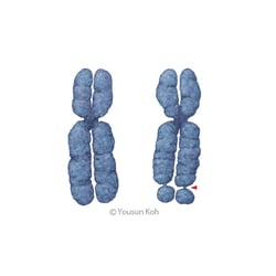 X-Chromosom
