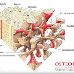 OSTEOPOROSE, Illustrationen für „Orthopädie & Unfallchirurgie“ /  2011