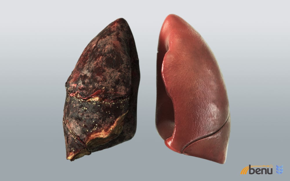 Realtime Lung – VR Experience