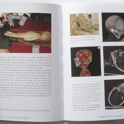 LAYOUT | Abschlussarbeit | Medical Art – University of Dundee | 4