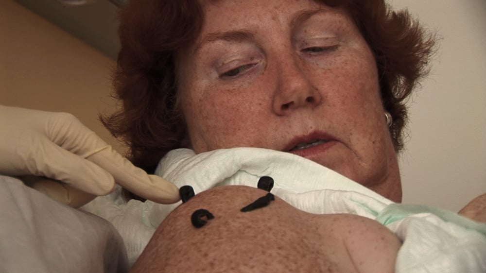 über Patientengeschichten wird erklärt, wie diese Tierchen unser Leben verändern können.