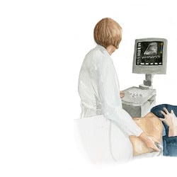 Sonographie
