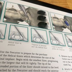 2014 – Broschüre für Ilion Medical, Innenseite