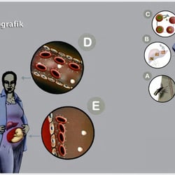 Infografik