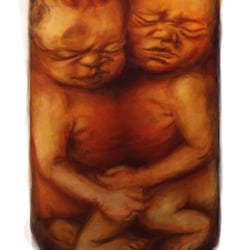 MORBID ANATOMY II