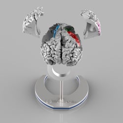 The Brain 3D Visualisierung für Uni Klink Bonn Neurologie
