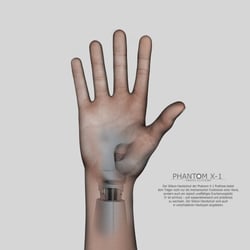 Phantom X-1 – Bionische Armprothese