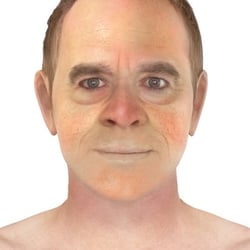 PFV Antlitzdiagnostik Male No10