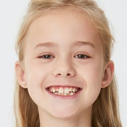 Kids
