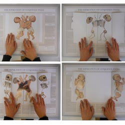 Siamesische Zwillinge | Museum-Informations Plakate | 2