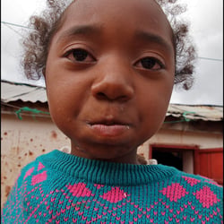 Bonjour – Madagaskar