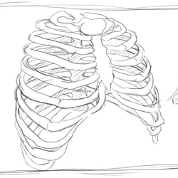 MedXpert STRACOS 3D‑Rippenklammer 3D-Animation Storyboard