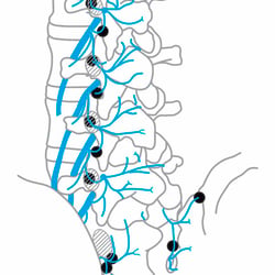 Minimalinvasive Wirbelsäulen Intervention 03