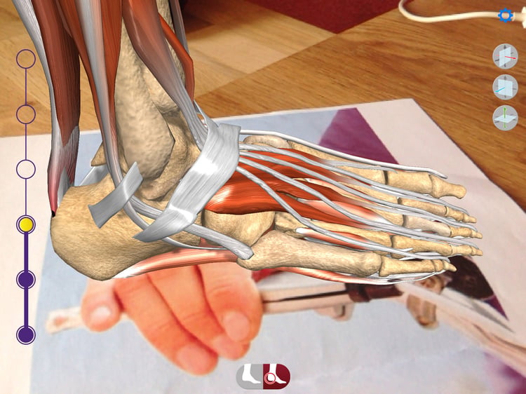 Augmented Reality App zu Erkrankungen des Fusses