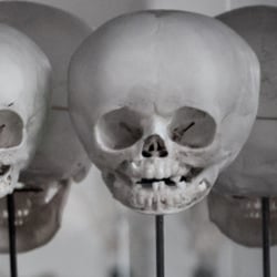 Anatomisches Institut Bonn 1
