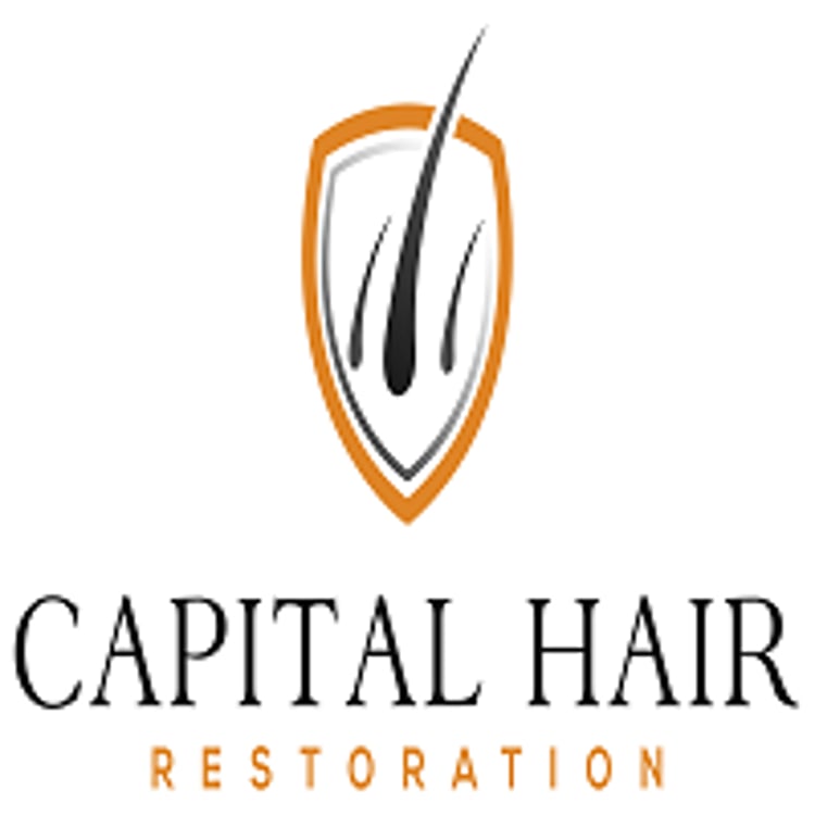 Hair Transplant Essex