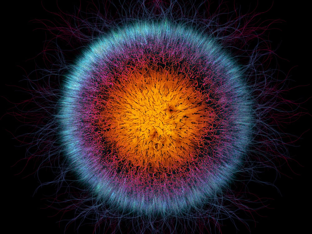 nucleolus