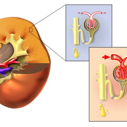 Schaubild Diabethes (Nephropathie)