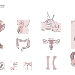 Ilja Cypa, Illustration