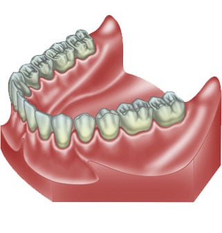 Zahntechnische Illustration