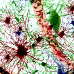 Gehirnzellen: rot – Astrozyten, grün- Neuronen, blau- Gliazellen
