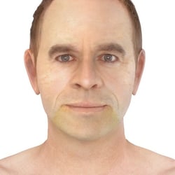 PFV Antlitzdiagnostik Male No6