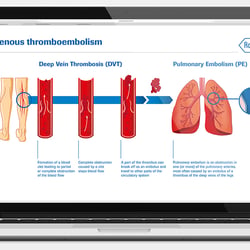 Roche Diagnostics, inklusive Erstellung der Illus