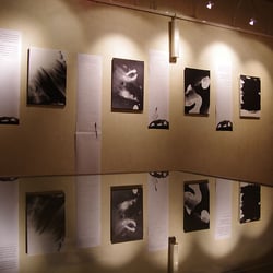 Alzheimer in camera oscura