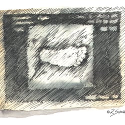 ULTRASCHALL-BILD