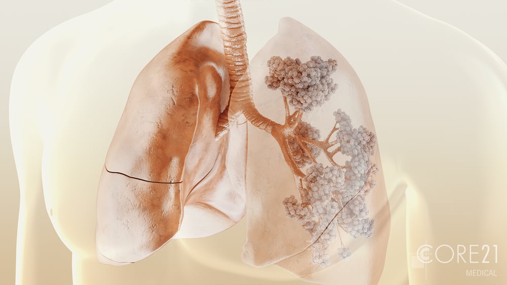 3D-Animation Lunge Atemwege