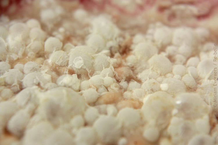 Fotografie aus der Reihe „Rhizopus“