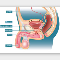Blasenkrebs Illustrationen – Anatomie Mann