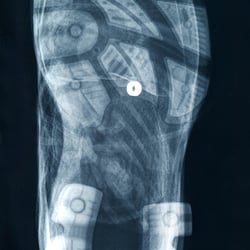 x-ray