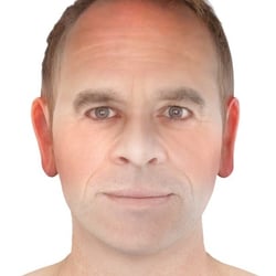 PFV Antlitzdiagnostik Male No3